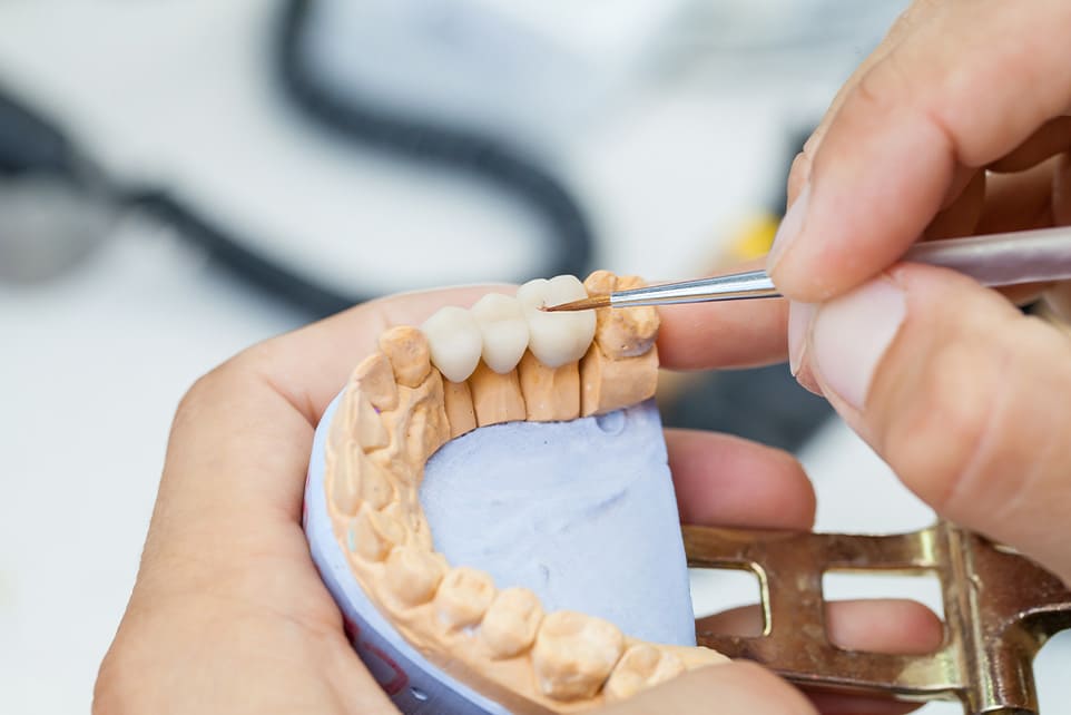 歯科技工士が立ち会い、精度の高い入れ歯・セラミック治療を叶える