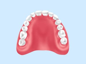 レジン義歯（保険適用）
